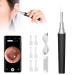 Earsworm remover Otoscope intelligent thermostat WiFi Otoscope ear cleaner with LED 5 million pixels hd wifi ears cleaning ear wax for children adults and oldest (black)