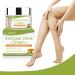 Varicose Veins Cream: Spider Vein Treatment for Legs - Improve Blood Circulation, Fast Relief - Buy Online on GoSupps.com