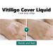 Natudeco 20ml Vitiligo Concealer Liquid Waterproof Skin Concealer with Brush for Face and Body Coverage for Vitiligo and Other Skin Conditions - Buy Online on GoSupps.com