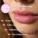 Lip Plumping Device - BLAfit by Bella Lip Appliance | Anti-Aging Tool for Plumper Lips, Firmer Skin, and Defined Jawline (Lavender) - Buy Online on GoSupps.com