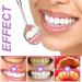 Shop Lila Tooth White Stripes - Powerful Whitening Kit | Color Correction & Essential Oils | Peroxide-Free & Sensitive Friendly | International Shipping - Buy Online on GoSupps.com