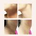 Japan Neck Collagen Whitening Cream Neck Hydrolyzed Collagen Neck Cream Dark Spot Repair Cream Whitening Cream For Dark Skin - Buy Online on GoSupps.com