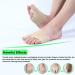 LOEFLIVG 2-PCS Bunion-Pads Toe Separator Bunion Corrector with Gel Relief Pads Thumb Valgus Corrector Orthopedic Straps Toe Splints for Women & Men(Large Size)