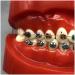 Orthodontic Teeth Model Dental Typodont with Metal Brackets & Ligature Ties - Red | International Shipping Available - Buy Online on GoSupps.com