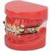 Orthodontic Bracket Model - 24 Teeth Demonstration Model with Metal Wires & Brackets for Dental Education - Buy Online on GoSupps.com