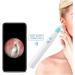 JYYBN Wireless Ear Cleaner with LED Camera - Ear Wax Removal Tool for Kids & Adults - Buy Online on GoSupps.com