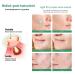 Acne Pimple Patch | Hydrocolloid Cover | 120 Pack | Star Heart Shape | Zit Breakouts & Blemish Spot Stickers - Buy Online on GoSupps.com