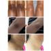 GFOUK Acanthoclear Therapy Spray - Dark Spot Corrector for Black Skin (1PCS) - Buy Online on GoSupps.com