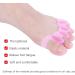 Evtscan Toe Separator - 4 Pairs Silicone Bunion Pain Relief & Correction Tool - Blue | Best Orthotic Solution - Buy Online on GoSupps.com