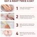 FOMIYES Nail Polish Decked Accessories Professional Nail Polish Nail Art Accessories Fungus Fighting Nail Polish Accessories Nails Serum Frosted Plastic Care Solution - Buy Online on GoSupps.com