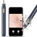 Blackhead Remover Tools Pimple Popper with Camera Visible Pore Cleaner Waterproof Acne Comedone Whitehead Extractor Kit for iPhone/Android - Buy Online on GoSupps.com