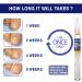 Maximum Strength Nail Fungus Treatment Pen for Toenails & Fingernails, Clean and Repair Nails from Fungus - Buy Online on GoSupps.com