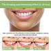 Ampoule Toothpaste & Serum - 3V Fruit Acid Tooth Whitening Essence | International Shipping Available - Buy Online on GoSupps.com