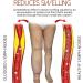 Mediginger Anti-Swelling & Cellulite Firming Ointment for Legs (5PCS) - Buy Online on GoSupps.com
