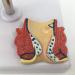 Pathological Hemorrhoids - Injury Model of Hemorrhoids Colorectal - Placed On Base - The Best Educational Support for Communication - Buy Online on GoSupps.com