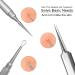 SG Nekoo Professional Facial Milia & Whitehead Removal Tool - Stainless Steel Double Ended Needle Tweezers for Blemish, Pimple & Acne - Silver Pack Of 1 - Buy Online on GoSupps.com