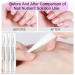 Nail Skin Oil & Care Stick - Cuticle Treatment Set | 3 Nail Oils Hardener Pen (4ml) for Healthy Nails - International Shipping Available - Buy Online on GoSupps.com