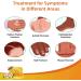 Tonkog Bee Venom Psoriasis Treatment Cream - Soothing and Moisturizing Skin Therapy (5 PCS) - Buy Online on GoSupps.com