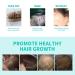 FIOERDTUIE Women Men Hair Growth Essence Roller Natural Ingredient Regrowth Follicle Moisturizing Nourishing Serum Haircare - Buy Online on GoSupps.com