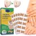 Nail Patches  Health Toenail Corrector Patch  Ingrown Toenail Corrector Strips  Professional Toenail Treatment Tool Foot Care(50PCS)