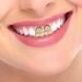 Didiseaon 2pcs Gold Decor Grills Grill Teeth Hip-hop Supplies Props Clothing Men and Women The Cross - Buy Online on GoSupps.com
