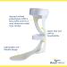 AFO Swedish Leaf Spring Drop Foot Brace | Lightweight Moldable Orthosis for Men & Women - PDAC L1930 Right - Buy Online on GoSupps.com
