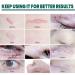 Scar Repair Serum - Effective Treatment for Old and New Scars | Men and Women | 2pcs - Buy Online on GoSupps.com