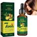 30ml Hair Serum Fast Hair Growth Hair Loss Stopping Fast Hair Growth Hair Loss Treatment for Men and Women