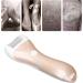 Electronic Foot Pedicures Kits Electric Foot File Feet Care for Hard Cracked (DOACTst9mv165wo-12) - Buy Online on GoSupps.com