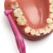 Buy Cep Interdent Tepe Angle 0.4mm - 6 Pink Pieces Pack for Optimal Oral Care | International Shipping Available - Buy Online on GoSupps.com