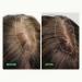 Scandinavian Biolabs Hair Strength Shampoo & Bio-Pilixin Serum for Women | Strengthen & Moisturize Hair with Gentle Clean Formula - International Shipping Available - Buy Online on GoSupps.com