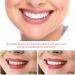 Instant Smile with Teeth Veneers | Fake Teeth for Men & Women | Whiten Bad Teeth | Perfect for Couples - Buy Online on GoSupps.com