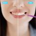 50 PCS Interdental Brush Braces Cleaner - Dental Flossing Head Oral Hygiene Tool Set (5 Colors/Sizes) | PHSZZ - Buy Online on GoSupps.com