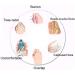 Summer Bunion Splints Flip Flops - Orthopedic Corrector Sandals for Women - Buy Online on GoSupps.com