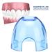 5-Piece Mouth Opener Set | Oral Lip Holder for Dental Practices & Tooth Lighting Salons - Blue Transparent - Buy Online on GoSupps.com