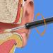 BTSEURY Rechargeable Wireless Visual Ear Cleaner - Ear Wax Remover Tool for Earwax Cleaning in Black - Buy Online on GoSupps.com