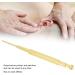 Buy Ear Acupuncture Point Probe - Multifunctional & Comfortable for Home & Hospital Use - Buy Online on GoSupps.com