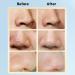 Blackhead Remover Solution 500ml - Deep Cleansing for Soft Skin Pore Cleaning & Moisture Boost | International Shipping - Buy Online on GoSupps.com