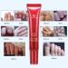 Herbal Foot Nail Cream Protector Skin Care Cream Ointment Treatment Toe Nail Onychomycosis Paronychia Anti Fungal Treatment Nail Repair Cream 15g - Buy Online on GoSupps.com