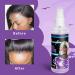 Lace Glue Remover Spray 3.38FL.OZ - Easy & Skin-Friendly Double Sided Tape Remover for Wigs & Hair Extensions - Buy Online on GoSupps.com
