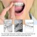 LOVEWEE Clear Aligner Removal Tool - 2 Pcs Set for Invisible Braces - Oral Care Accessories - Buy Online on GoSupps.com