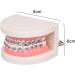 Dytah Orthodontic Demonstration Model - Teeth Study Model with Metal Arch Wire & Brackets for Effective Teaching - Buy Online on GoSupps.com