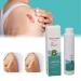 Effective Scar Removal Spray - Stretch Strip Care for Injuries - Gentle Skin Treatment - 20g - Buy Online on GoSupps.com