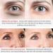 Magic Eye Cream - Anti Aging Treatment for Under Eye Bags, Wrinkles, Puffiness & Dark Circles - Buy Online on GoSupps.com