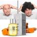 BOKIOESDE Ginger Hair Growth Prevent Hair-Loss Essential Oil Nutrient Solution Fast Growing Scalp Beauty Health Men - Buy Online on GoSupps.com