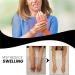 Supyini Lymphatic Drainage Magnetic Ring Set - 2-Piece Weight Loss & Detox Copper Ring for Arthritis Relief - Buy Online on GoSupps.com