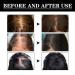 Alopecia Hair Growth Oil for Women & Men | Natural Hair Loss Treatment Serum | Fast-Acting Vegan Scalp Fertilizer - Buy Online on GoSupps.com