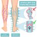 Venenwalker Basic Vein Therapy - Certified Medical Device for Vein Health | Effective Relief for Lipedema Lymphedema & Post-Sports Regeneration - Buy Online on GoSupps.com
