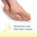 SDMAX 1x Foot Powder Foot Odour Eliminator Talc Stinky Soft Feet Powder Soothes Refreshes (Pack of 1) 170.00 g (Pack of 1) - Buy Online on GoSupps.com