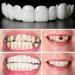 Fluktrix Adjustable Silicone Dentures - 2 Pairs of Brightening Upper & Lower Cosmetic Artificial Teeth for a Perfect Smile - Buy Online on GoSupps.com
